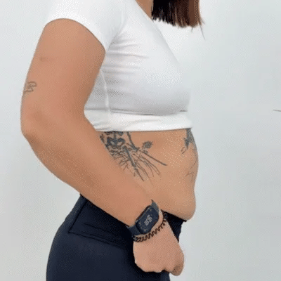 🔥Last Day 49% OFF - 2026 New Women's Tummy Control Butt-Lifting Shapewear